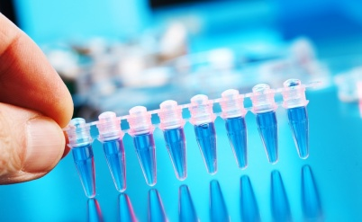 בדיקת רקמות - מתי בית המשפט יורה על קיומה?